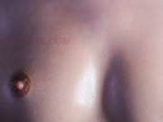 Bonniebruise