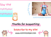 mykinkydope