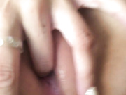 miaa2