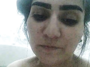 Rareee1