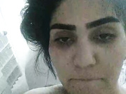 Rareee1