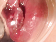 Mississchmitt 140521