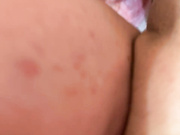 beeinside