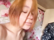 chiosan