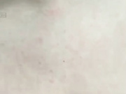 -Nezukoo- рачком и на лице